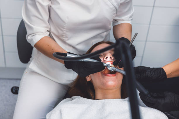 Best Knocked-Out Tooth (Avulsed Tooth) Treatment in Lealman, FL
